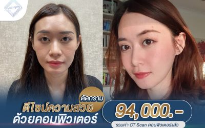 ตัดกรามออกแบบด้วยคอมพิวเตอร์