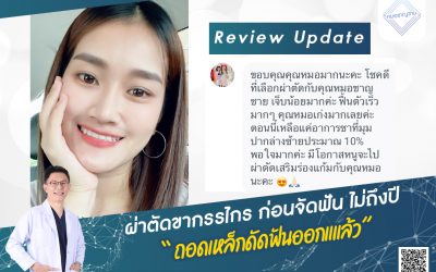 Update หลังผ่าตัดขากรรไกร 1 ปี