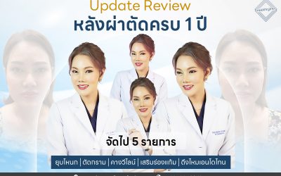 รีวิวยุบโหนก ตัดกราม คางวีไลน์ เสริมร่องแก้ม ดึงไหมเอนโดไทน