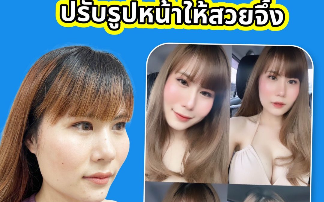 รีวิวผ่าตัดยุบโหนกแก้ม ตัดกราม ปรับรูปหน้าให้สวยจึ้ง