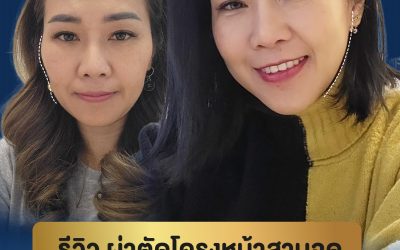 รีวิว ผ่าตัดโครงหน้าสามจุด