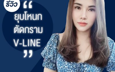 รีวิวยุบโหนก ตัดกราม V-LINE