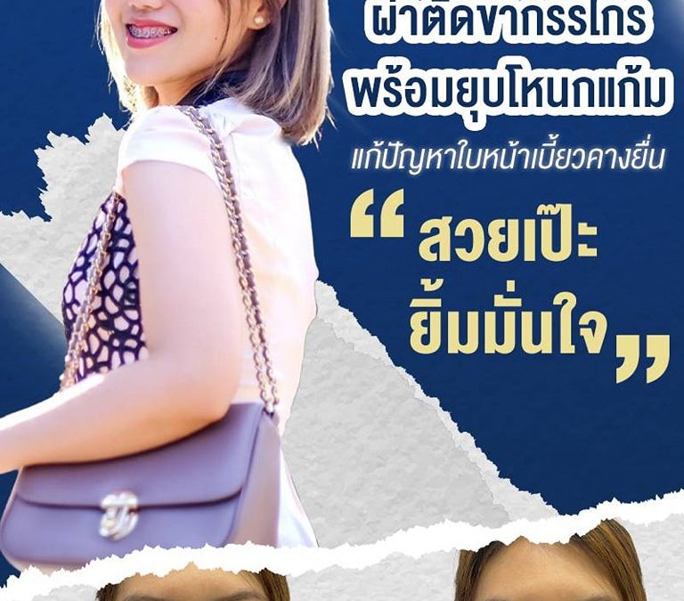 ผ่าตัดขากรรไกร พร้อมยุบโหนกแก้ม